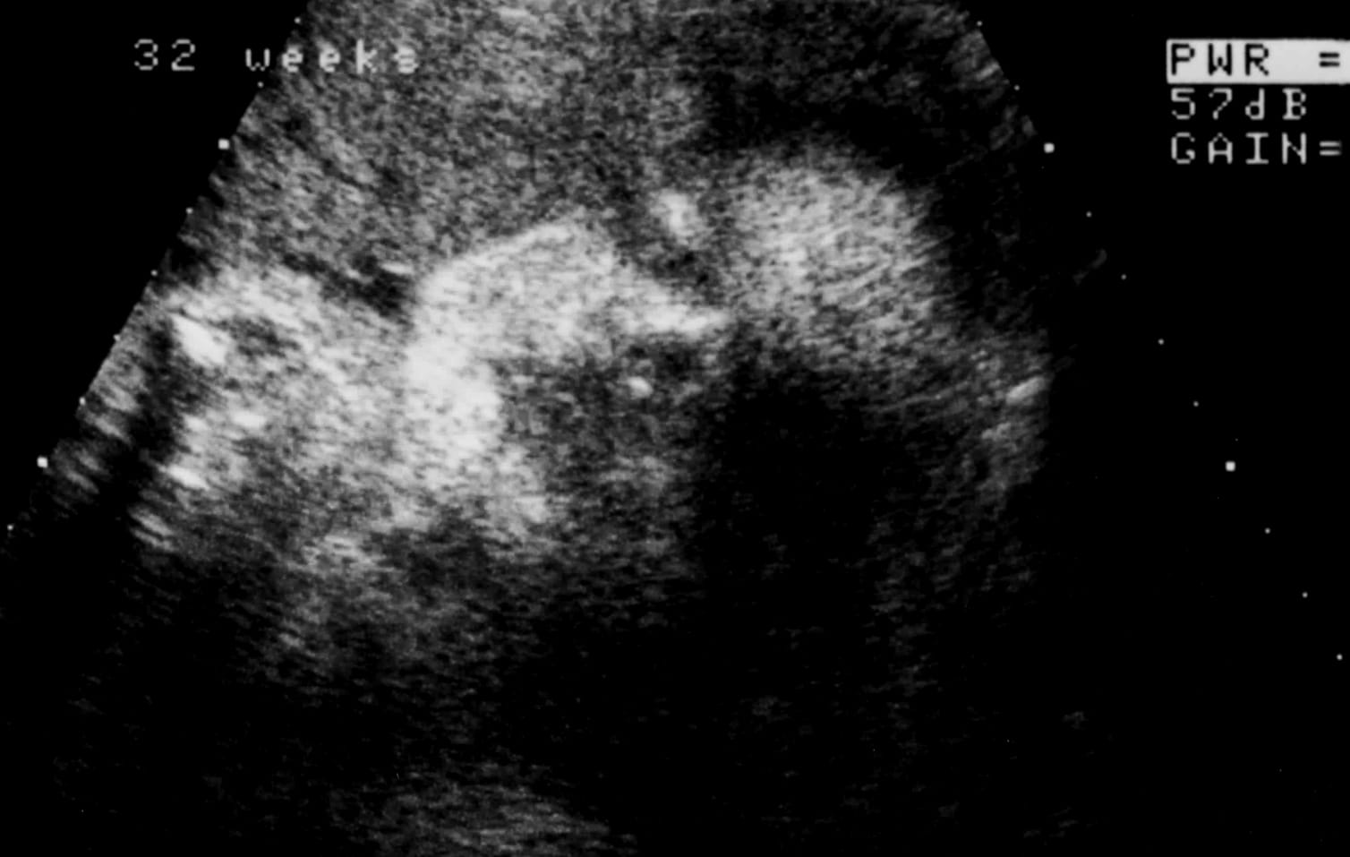 Layton Ultrasound Scan Crop 4
