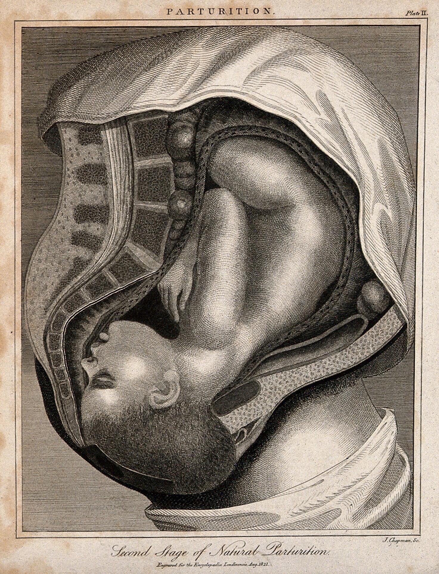 A cross-section of a pregnant woman's body in the final stages of labour. Engraving by J. Chapman, 1821. Wellcome Collection.