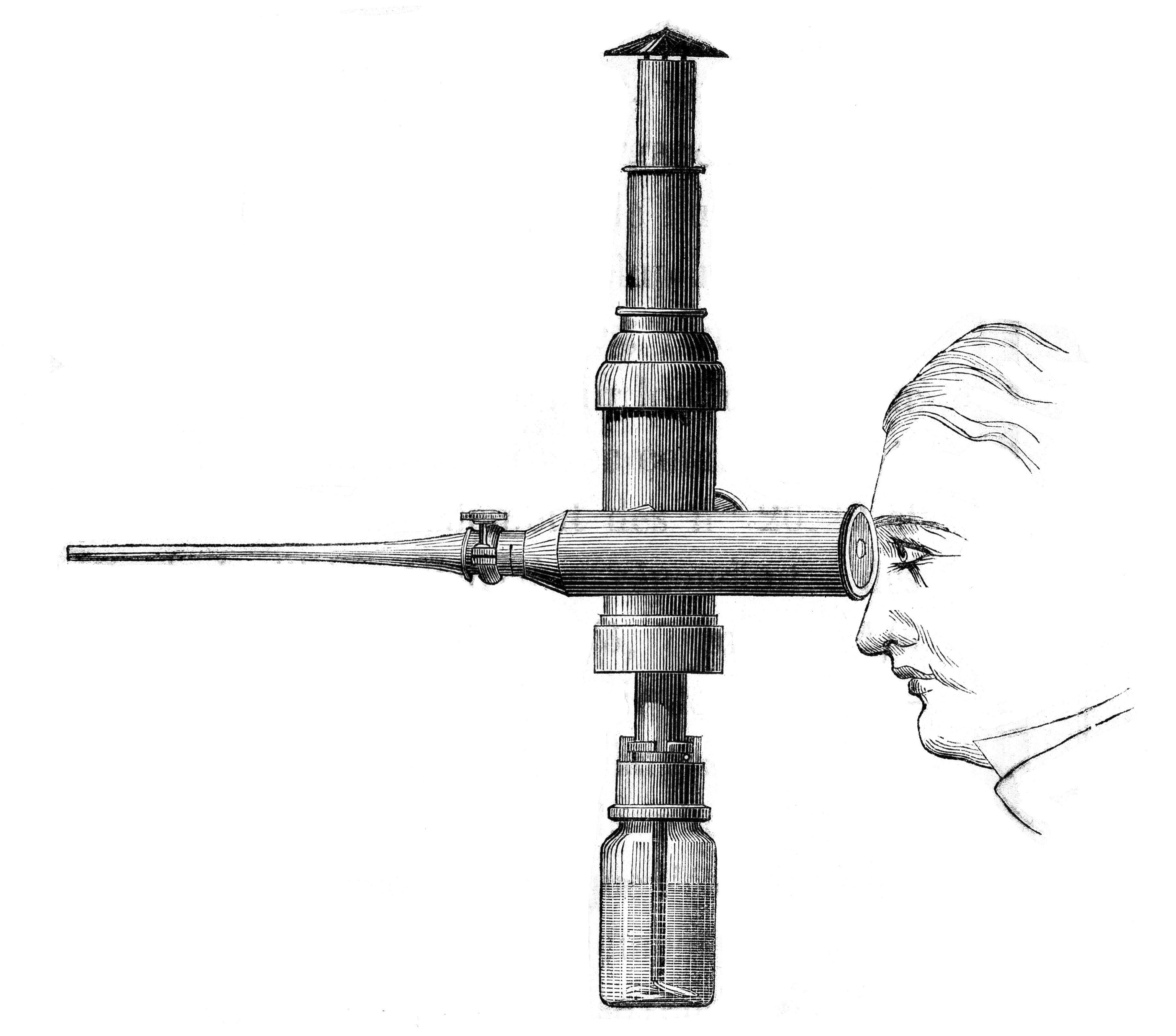 Desormeaux endoscope in use. Courtesy of Wellcome Collection, London. Attribution 4.0 International (CC BY 4.0)