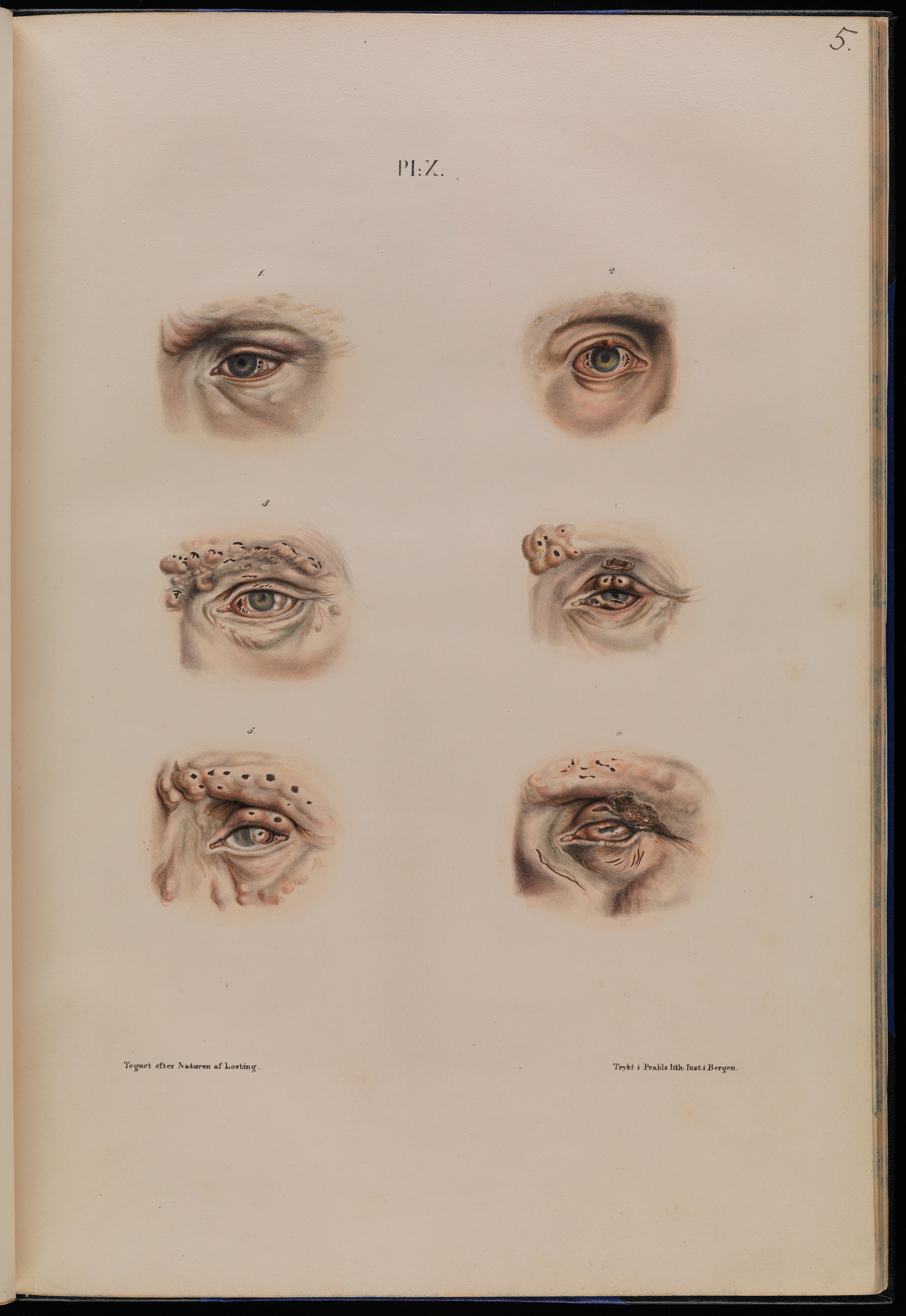 Fig. 5a: Various atlas images
